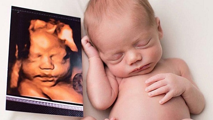 Siêu âm thai là quá trình thu thập hình ảnh của thai nhi trong bụng mẹ