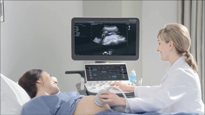 Siêu âm thai 4D là công nghệ siêu âm hiện đại nhất hiện nay