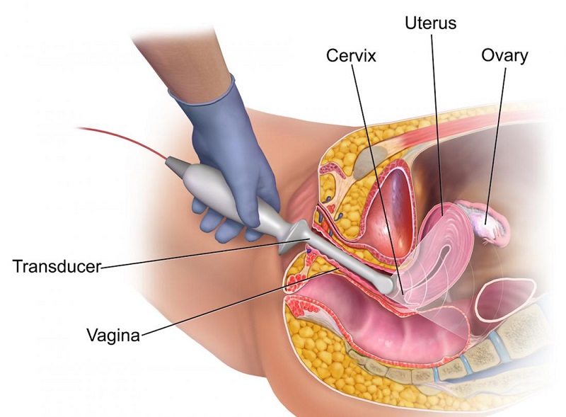 Siêu âm đầu dò giúp quan sát các phần bên trong của cơ quan sinh dục: tử cung, âm đạo, ống dẫn trứng,…