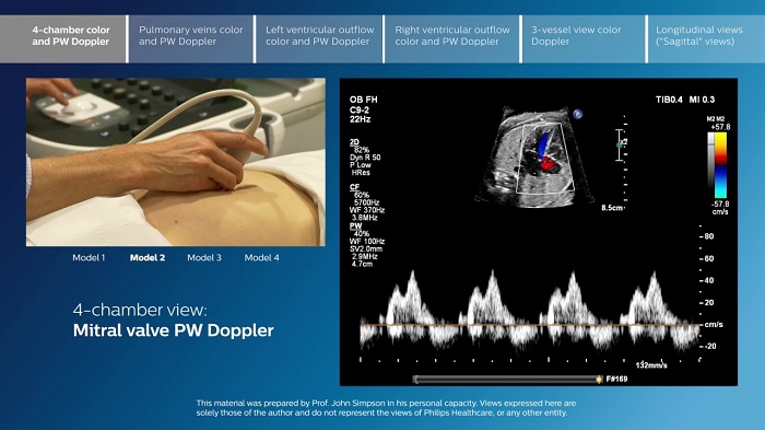 Siêu âm Doppler  là kỹ thuật siêu âm được tiến hành để đo lưu lượng máu ở nhiều bộ phận trong cơ thể bé