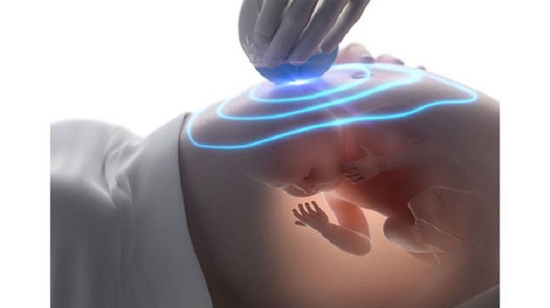 Siêu âm Doppler động mạch tử cung giúp kiểm tra lượng máu đến nhau thai có đầy đủ hay không