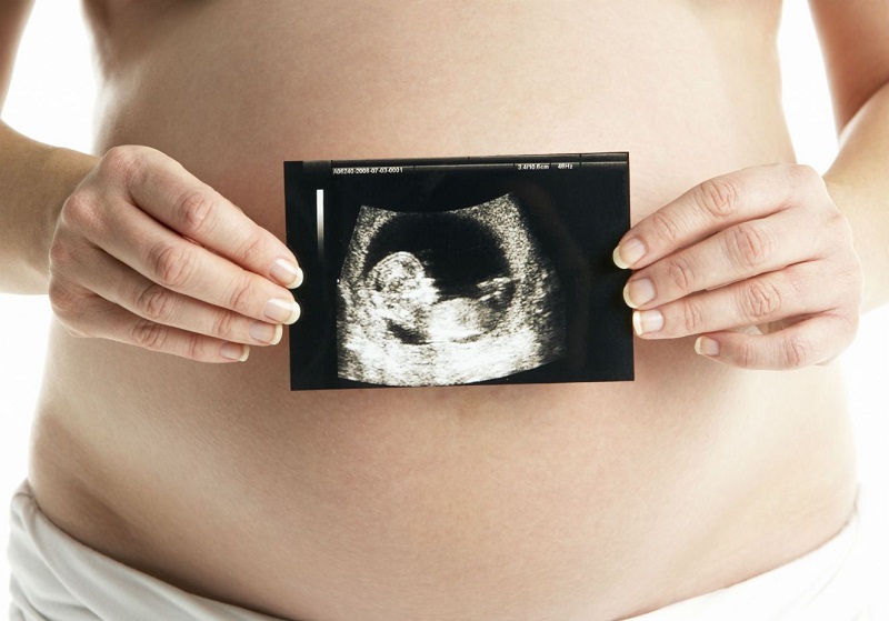 Các hình thức của siêu âm thai nhi phổ biến nhất là siêu âm 2D, 3D, 4D