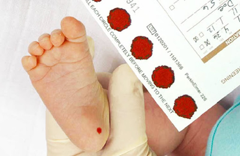 Sàng lọc sơ sinh được thực hiện bằng xét nghiệm máu gót chân