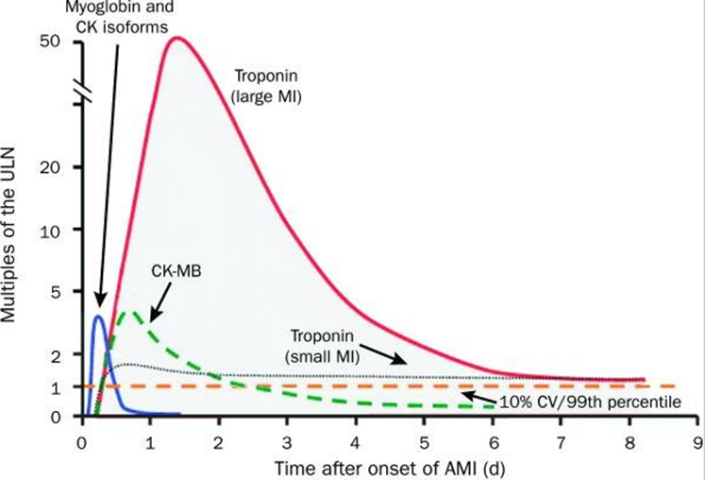 Sự thay đổi mức độ các troponin theo thời gian sau nhồi máu cơ tim cấp (AMI)
