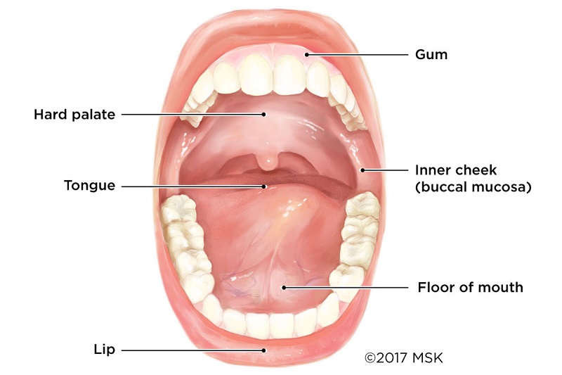Các loại ung thư khoang miệng