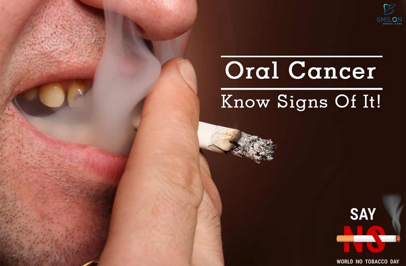 Hút thuốc lá là nguyên nhân hàng đầu gây ung thư khoang miệng