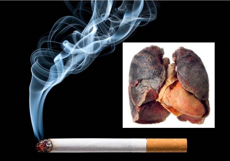 Hút thuốc lá là nguyên nhân chính gây nên ung thư phổi