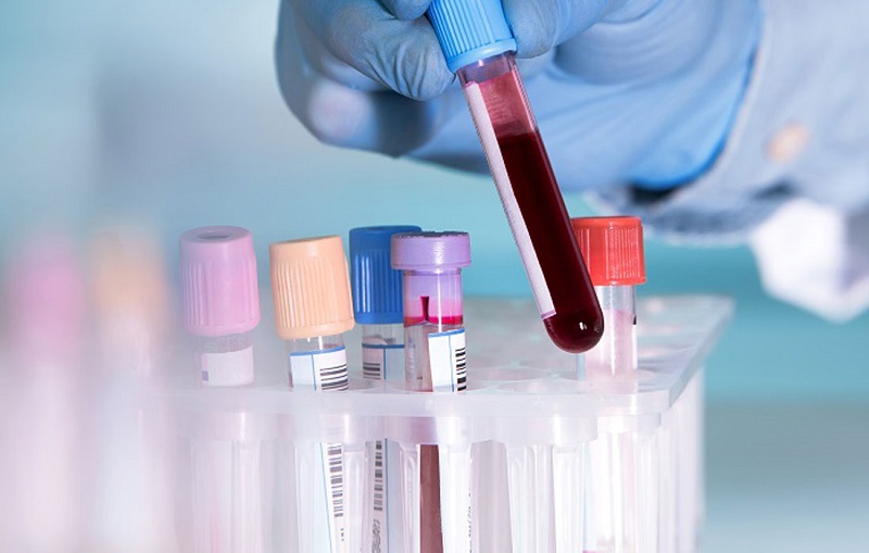 Xét nghiệm máu phục vụ cho quá trình khám và chữa bệnh