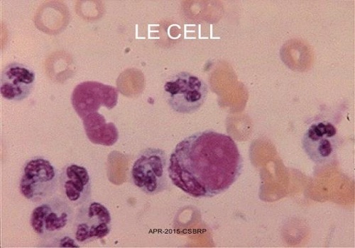 Tế bào LE