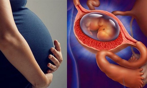 Chẩn đoán chính xác chửa ngoài tử cung, bệnh hiếm gặp ở thai phụ