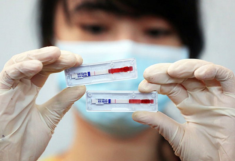Thời điểm được khuyến khích làm xét nghiệm HIV là 2 - 3 tháng sau khi nghi phơi nhiễm
