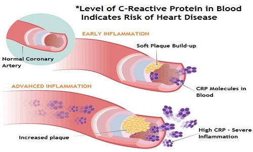 Vai trò của CRP trong phản ứng viêm