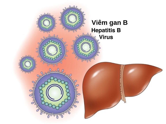 Viêm gan B do virus HBV gây ra có thể chuyển sang giai đoạn mãn tính nếu bệnh kéo dài hơn 6 tháng