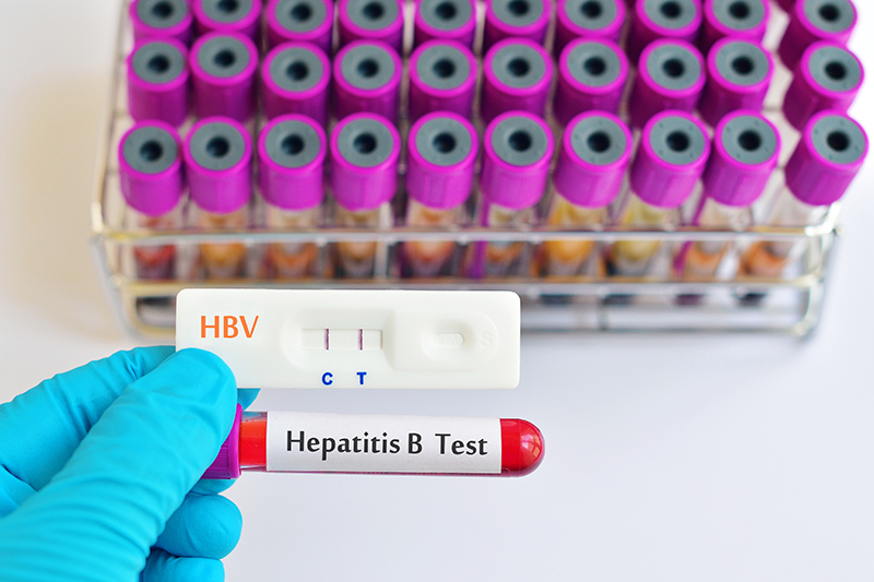 Xét nghiệm virus HBV giúp chẩn đoán bệnh viêm gan B
