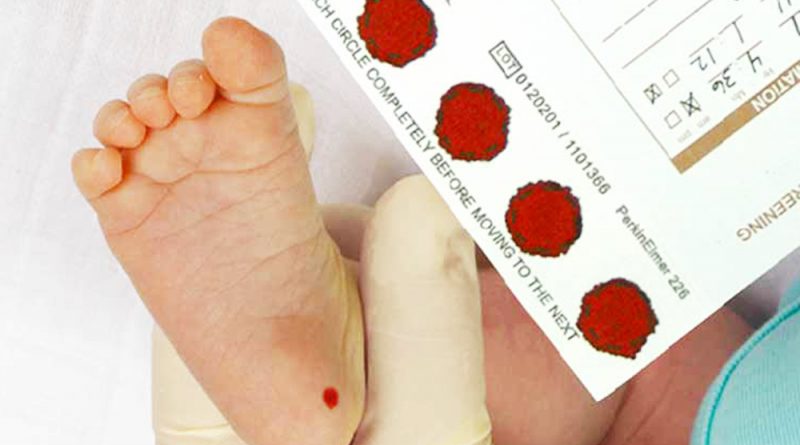 Xét nghiệm 17-OHP được tiến hành bằng cách lấy máu gót chân của <a href='https://medlatec.vn/tin-tuc/cach-cham-soc-tre-so-sinh-cho-nguoi-lan-dau-lam-me-s195-n18640'  title ='trẻ sơ sinh'>trẻ sơ sinh</a>