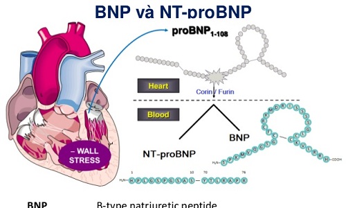Xét nghiệm BNP giúp kiểm tra tình trạng của bệnh suy tim