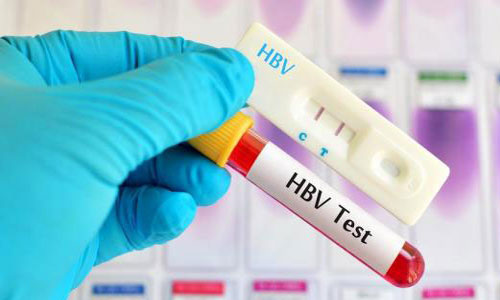 Xét nghiệm HBV được yêu cầu khi nghi ngờ kết quả HBsAg sai