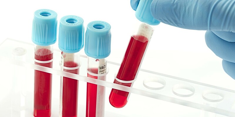 Xét nghiệm bạch cầu thường nằm trong xét nghiệm phân tích máu
