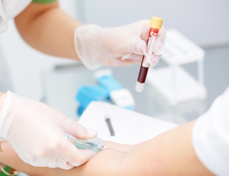 Xét nghiệm CMV với mẫu máu