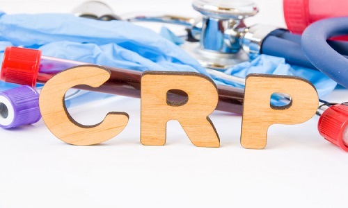 Xét nghiệm CRP có vai trò trong chẩn đoán viêm