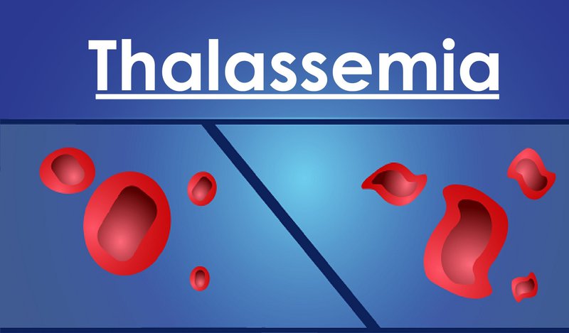 Hội chứng Thalassemia