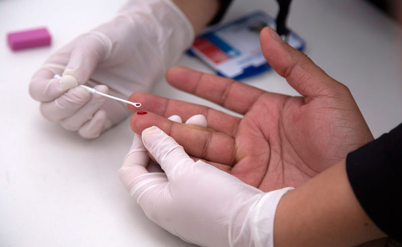 Xét nghiệm HIV để sớm phát hiện bệnh.