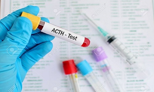 ACTH - Một hormone tuyến yên giúp đánh giá bệnh lý tuyến yên và thượng thận