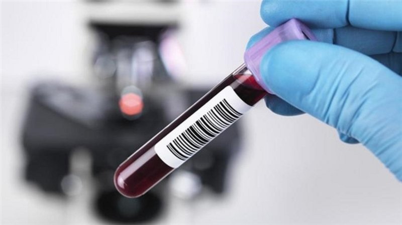 Xét nghiệm sinh hóa máu có thể đánh giá tình trạng của các bộ phận trong cơ thể