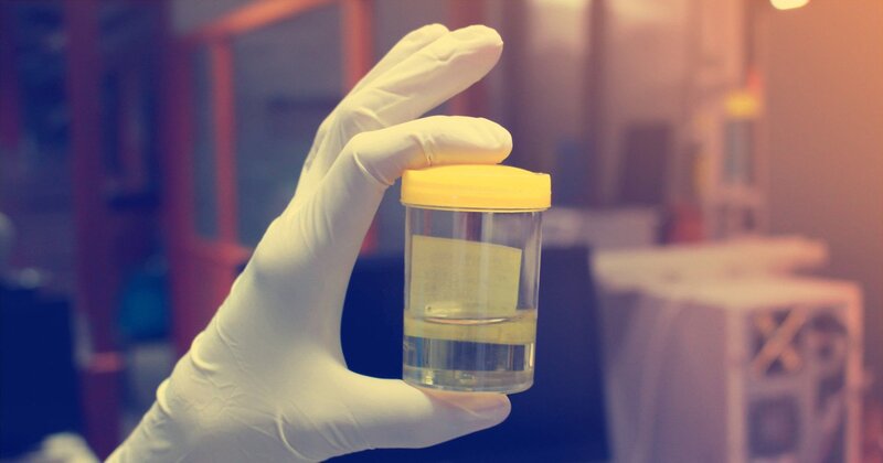 Xét nghiệm ma túy bằng nước tiểu là phương pháp phổ biến nhất