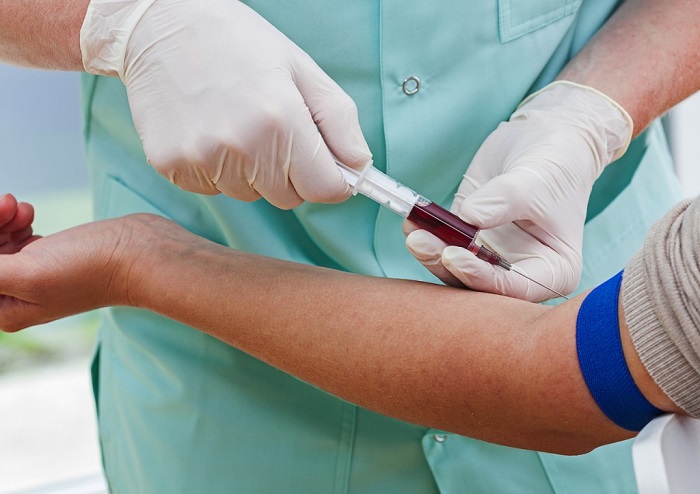 Trước khi tiến hành xét nghiệm máu cần lưu ý cung cấp thông tin dùng thuốc cho bác sĩ