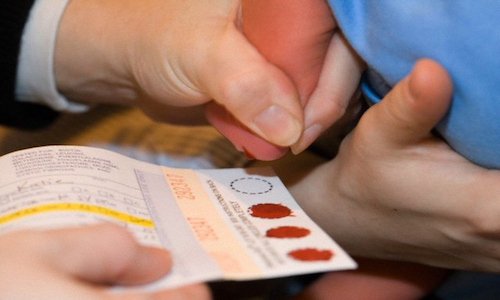 thực hiện xét nghiệm máu gót chân của trẻ sơ sinh