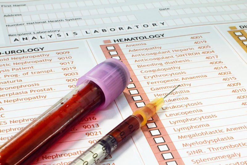 Xét nghiệm máu là xét nghiệm giúp chẩn đoán bệnh viêm gan C rất chính xác