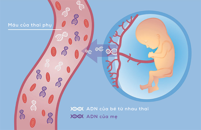 Xét nghiệm máu NIPT nhờ sự có mặt các cf-DNA thai nhi trong máu mẹ