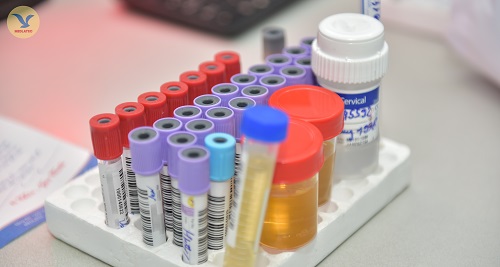 mẫu xét nghiệm viêm gan A được thực hiện đúng quy trình tại MEDLATEC