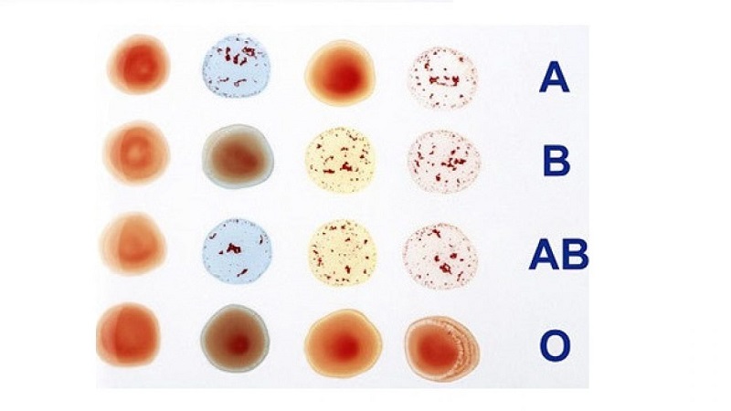 Có 2 hệ nhóm máu được ứng dụng phổ biến hiện nay là Rh và ABO