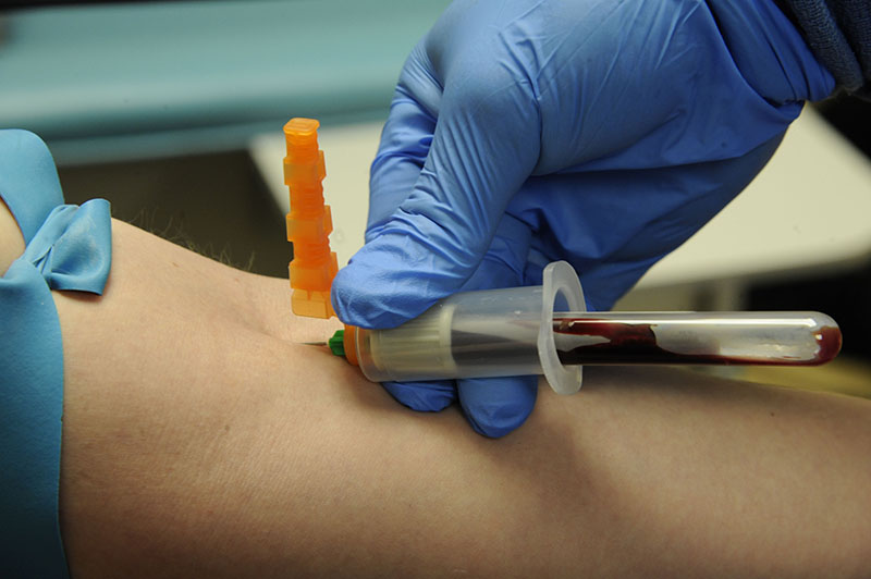 Mẫu xét nghiệm NIPT là mẫu máu được lấy trực tiếp từ tĩnh mạch cánh tay của mẹ