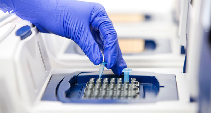 xét nghiệm PCR hỗ trợ phát hiện nhiều bệnh lý
