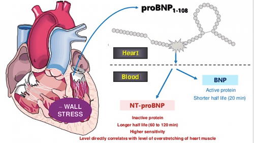 Xét nghiệm proBNP được sử dụng để chẩn đoán bệnh suy tim