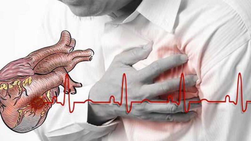 Chẩn đoán hoặc loại trừ khả năng suy tim với xét nghiệm Pro BNP