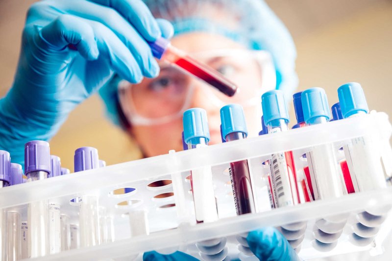 Các xét nghiệm kháng thể thực hiện trên mẫu máu bệnh nhân