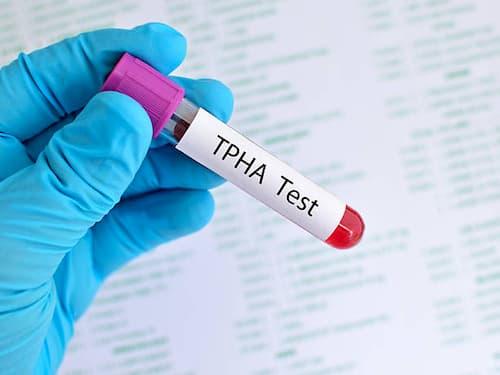 Xét nghiệm TPHA giúp phát hiện bệnh giang mai