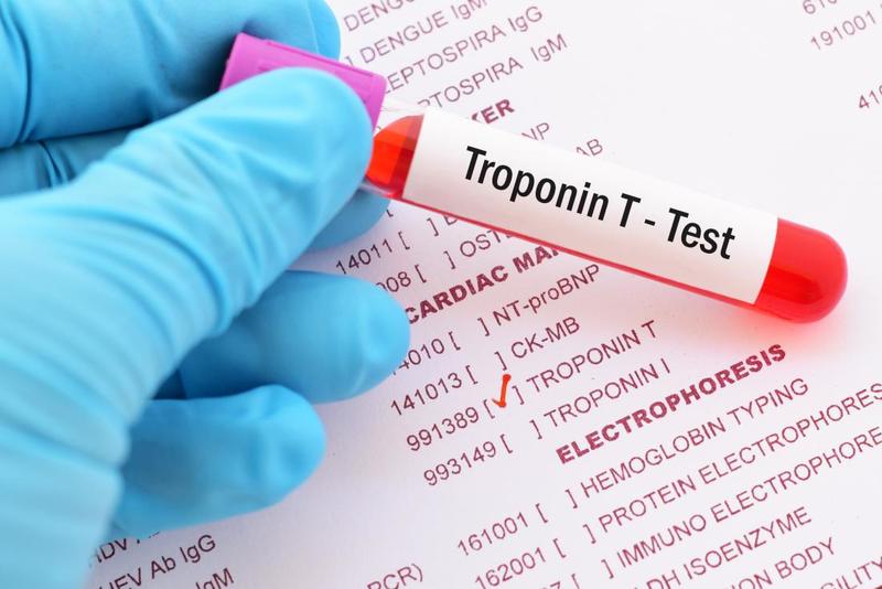 Xét nghiệm troponin T là đo lượng troponin T có mặt trong huyết thanh và huyết tương 