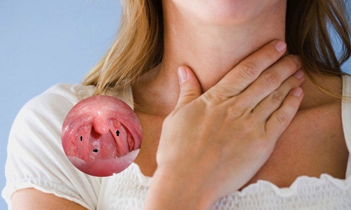 xét nghiệm ung thư vòm họng giúp tầm soát sớm ung thư vòm họng