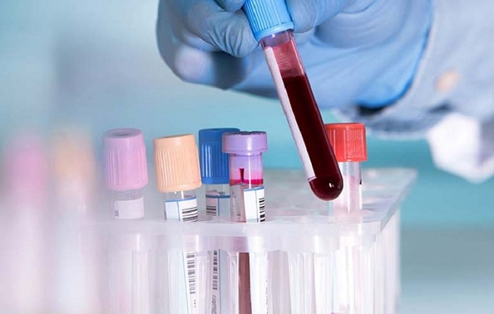 Tìm vi khuẩn HP bằng xét nghiệm máu
