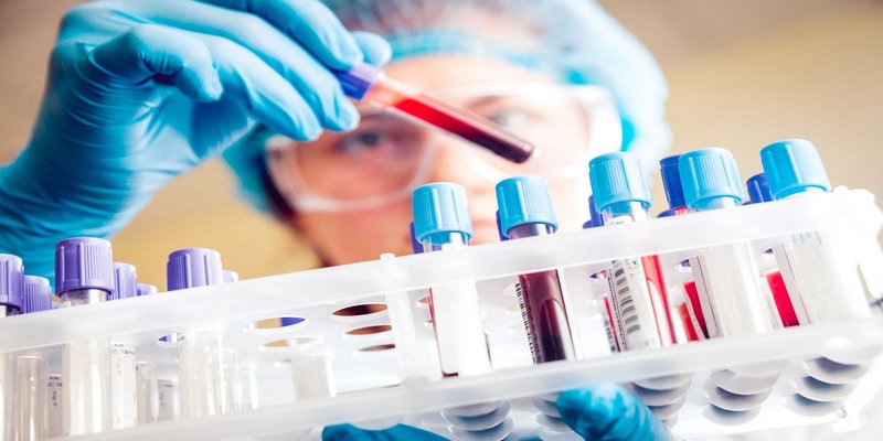 Xét nghiệm tổng phân tích máu tế bào ngoại vi là cần thiết trong xét nghiệm xuất huyết giảm tiểu cầu