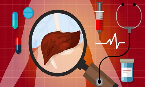 xét nghiệm chức năng gan giúp kiểm tra các bệnh lý về gan