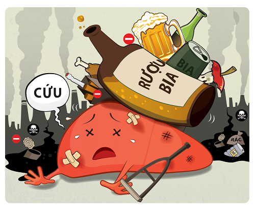Bệnh xơ gan cổ trướng thường gặp ở những người nghiện bia rượu