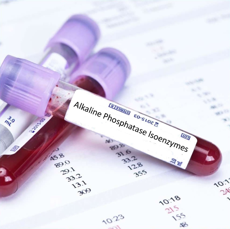 Xét nghiệm phosphatase kiềm được thực hiện và phân tích nhờ vào việc lấy mẫu máu