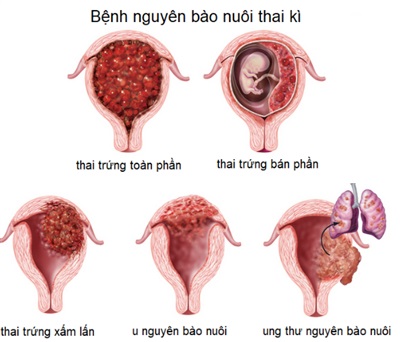 4. Triệu chứng và dấu hiệu nhận biết