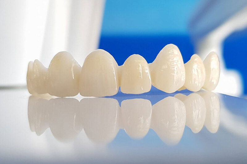 Răng sứ titan có cần đặt biện pháp phòng ngừa để tránh oxy hóa?
